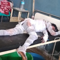 सिरहा - सिरहामा एक महिलालाई आफ्नै श्रीमानले मट्टीतेल छर्केर आगो लगाए