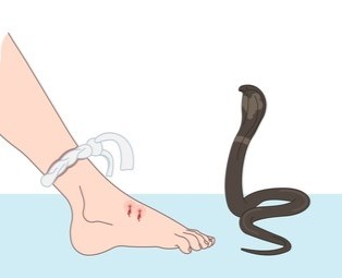 सर्पको टोकाइबाट कञ्चनपुरमा तीन वर्षीय बालकको मृत्यु,